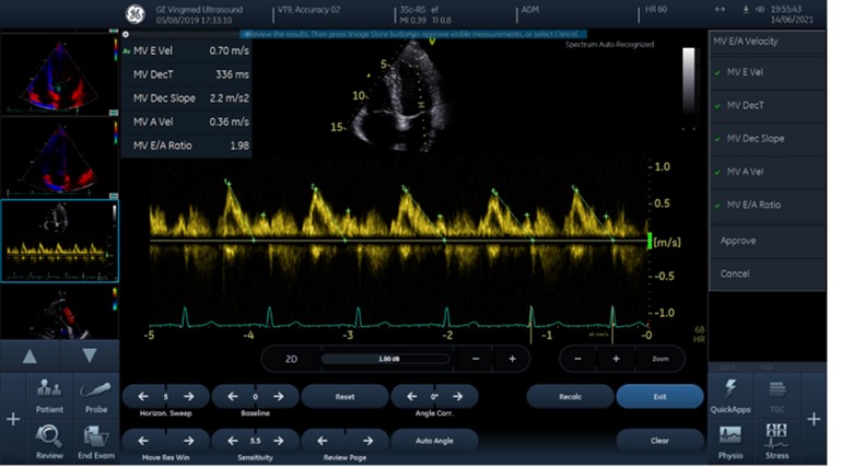 NMPA artificial intelligence software process optimization